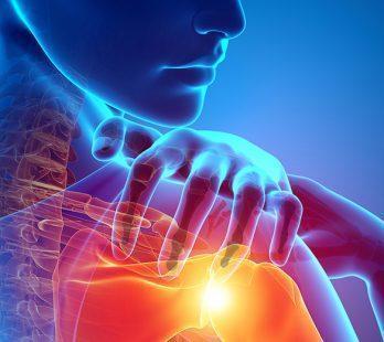 Rotator Cuff Repair