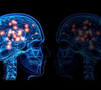 What is Multiple Sclerosis MS