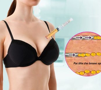 06 breast augmentation02