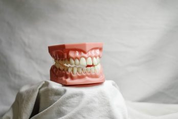 Dental Bridges