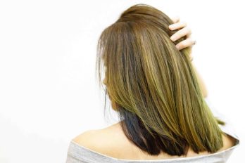 Understanding FUE Hair Transplant