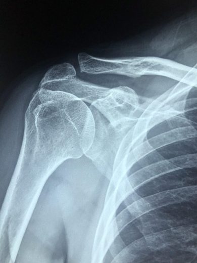 Orthopedic Surgery