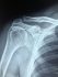 Orthopedic Surgery