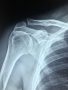 Orthopedic Surgery