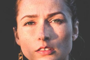 Rhinoplasty