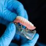 Dental Implants vs. Dentures