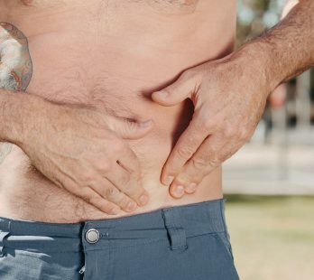 Hernia Repair in Mexico