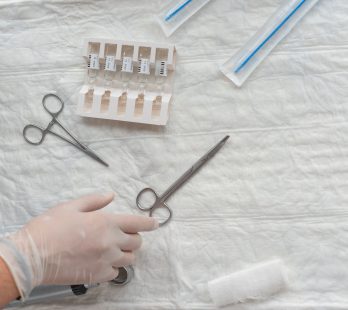 vasectomy reversal